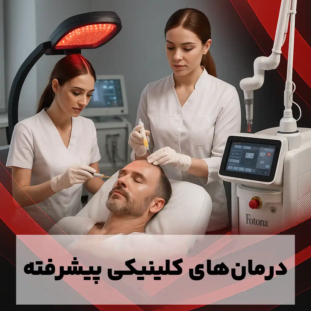 درمانهای کلینیکی پیشرفته در درمان ریزش مو درمانهای کلینیکی پیشرفته در درمان ریزش مو