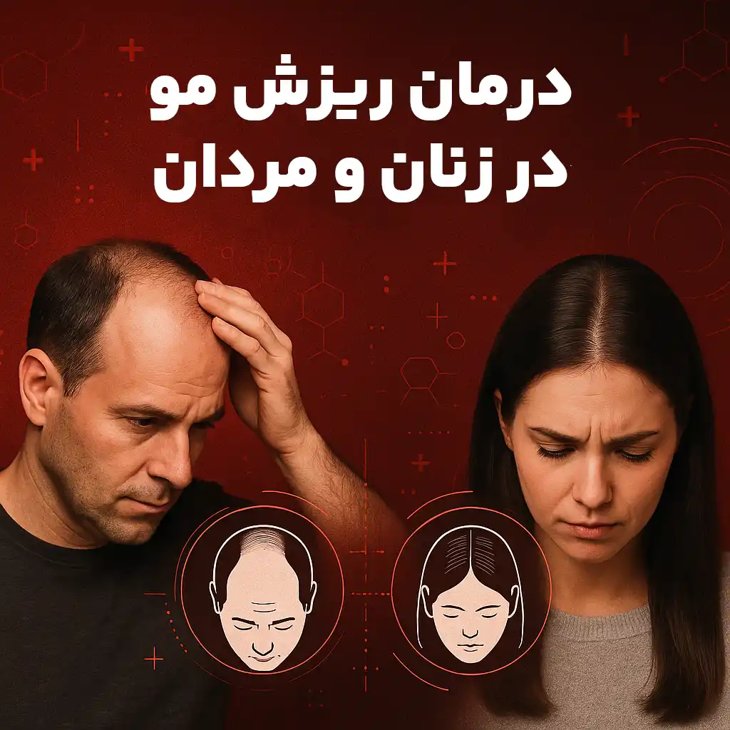 درمان ریزش مو در زنان و مردان: تفاوتها و شباهتها درمان ریزش مو در زنان و مردان: تفاوتها و شباهتها