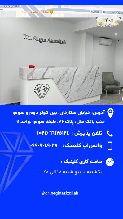 قیمت وسیله های لیزر